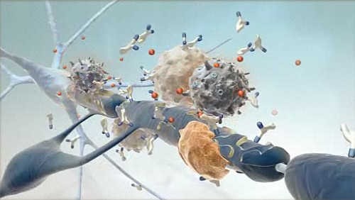 Skizze aus dem DMSG-Flash-Video:   Eine T-Zelle hat das Myelin der Markscheide angegriffen, welches sich nun unter dem weiteren Angriff der krpereigenen Immunabwehr zersetzt.